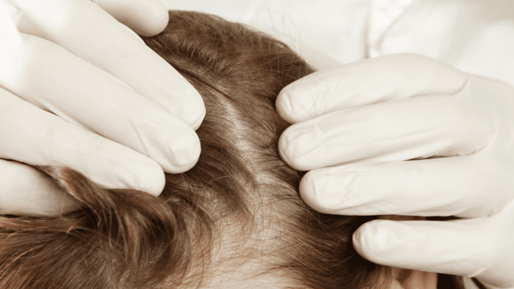Plaukų slinkimo stabdymo būdai