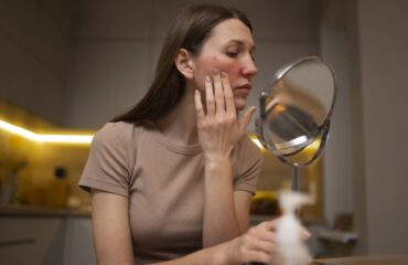 Kodėl atsiranda raukšlės, randai ir pigmentinės dėmės?